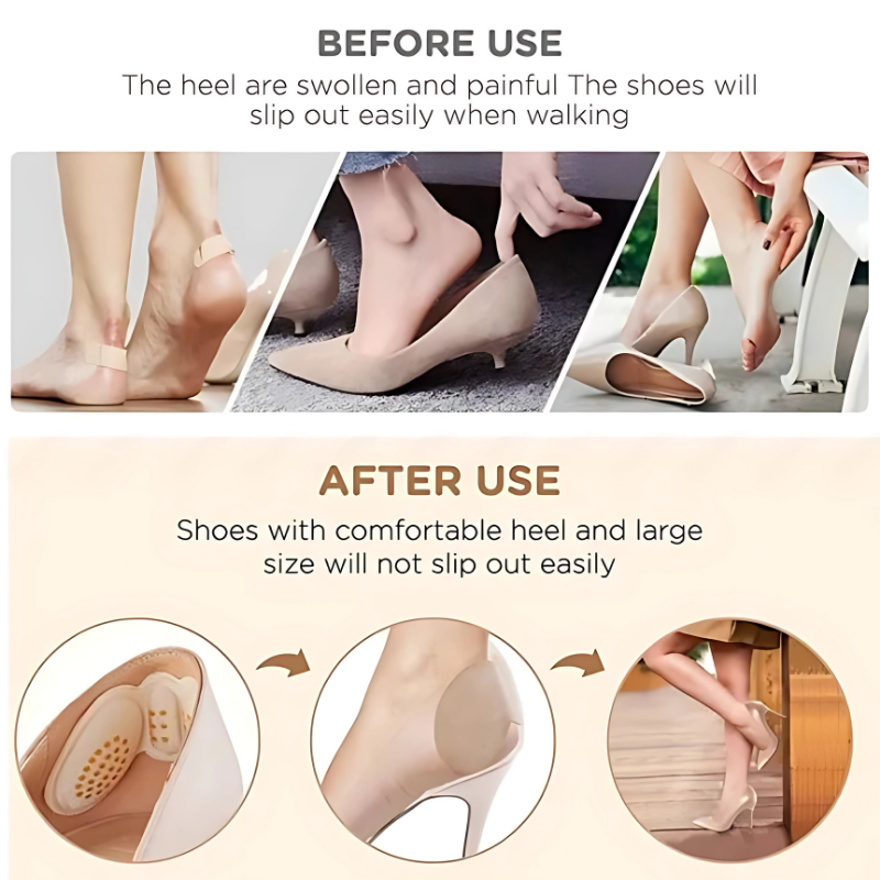 CloudWalk Inserts (Pair)