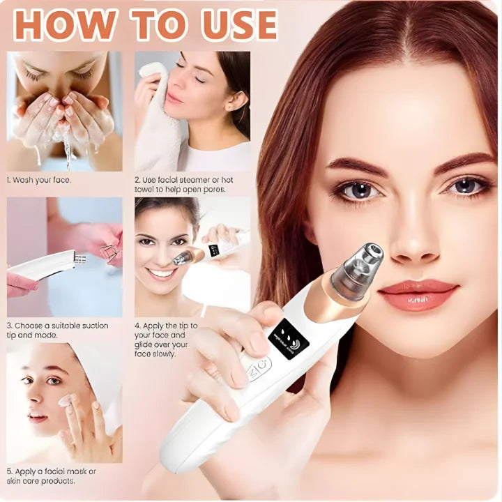 Professional Skin Refiner, Blackhead Remover, Pore Therapy (5 in 1)