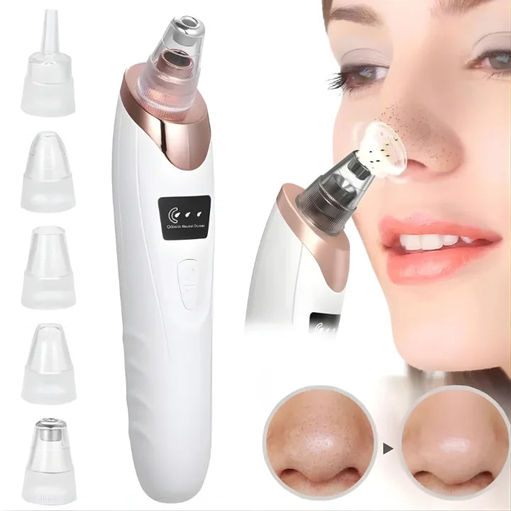 Professional Skin Refiner, Blackhead Remover, Pore Therapy (5 in 1)