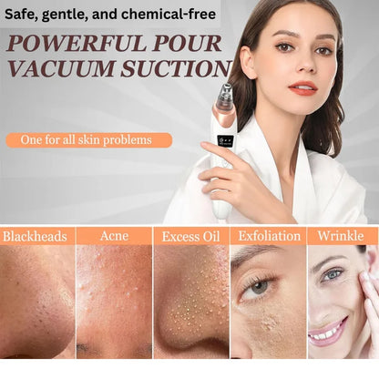 Professional Skin Refiner, Blackhead Remover, Pore Therapy (5 in 1)