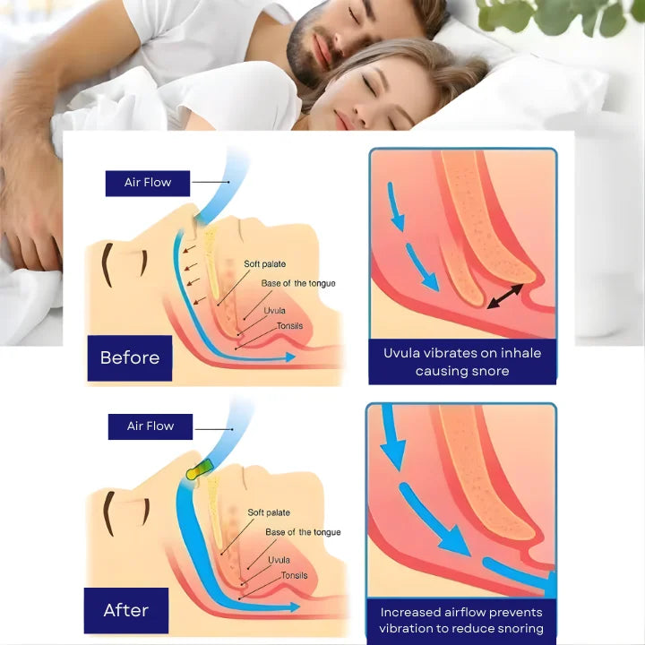 Breathe Easy Snore-Free Sleep Clips